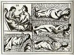 Aztec drawing of smallpox victims.  This disease killed many Aztecs