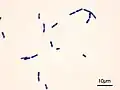 Bacillus cereus