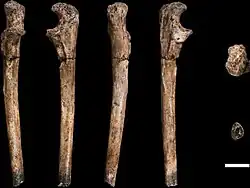 An ulna