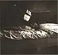 A starving child in the Łódź ghetto
