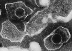 Electron microscope image of two Epstein-Barr virus viral particles. It shows round capsids (protein around the genetic material) loosely surrounded by the membrane envelope