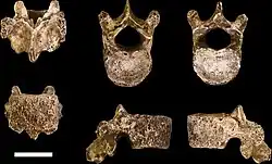 10th thoracic vertebra