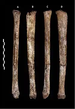 A tibia