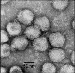 Electron micrograph of negatively stained Nam Dinh virus particles
