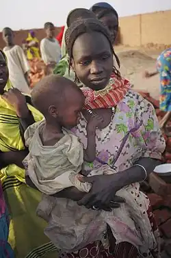 A starving refugee child