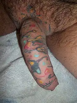 Penile skin