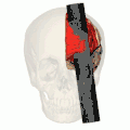 A 3D diagram of his injury