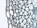 Collenchyma tissue