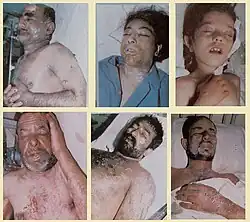 Victims of Iraq's attacks with poison gas