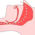 Normal breathing without obstruction