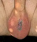 Scrotum or scrotal piercing, also called a Hafada piercing: Scrotal ladder piercing with rings