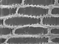 Parenchyma tissue